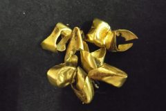 金歯